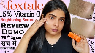 Foxtale Vitmin C Brightening Serum Review  | Vitmin C Serum For Dark Spots | Antima Dubey [Samaa]