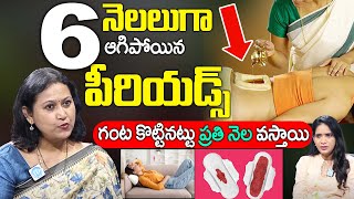 ఆగిన పీరియడ్స్ వచ్చేస్తాయి !! | Remedy For Get Periods in One Day | Irregular Periods | Dr. Jyothsna