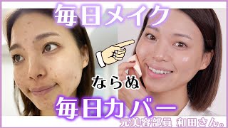 【凹凸ニキビに悩む方へ】時短で無かった事に！明日から使える基本の美肌カバーテク