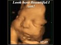 37 weeks in 3d 4d u0026 hdlive baby ultrasound.. a new conception ultrasound studio in ma . 781 878 1230