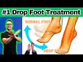 10 BEST Foot Drop Treatments & Exercises [Braces, Shoes, Orthotics]