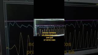 diagnóstico com ociloscopio compreçao relativo dos cilindros.