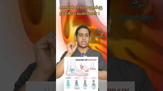 கணுக்கால் சுளுக்கு முக்கிய வகைகள்|Ankle Sprain grading|Ankle pain types|Ankle swelling grading