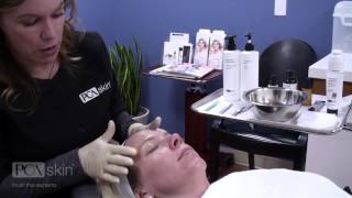 Dermaplaning And Pca Skin Professional Treatments