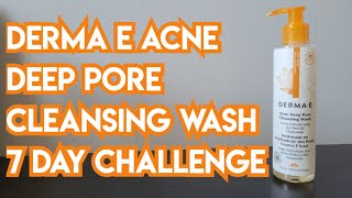 Derma E Acne Deep Pore Cleansing Wash Review - 7 Day Challenge