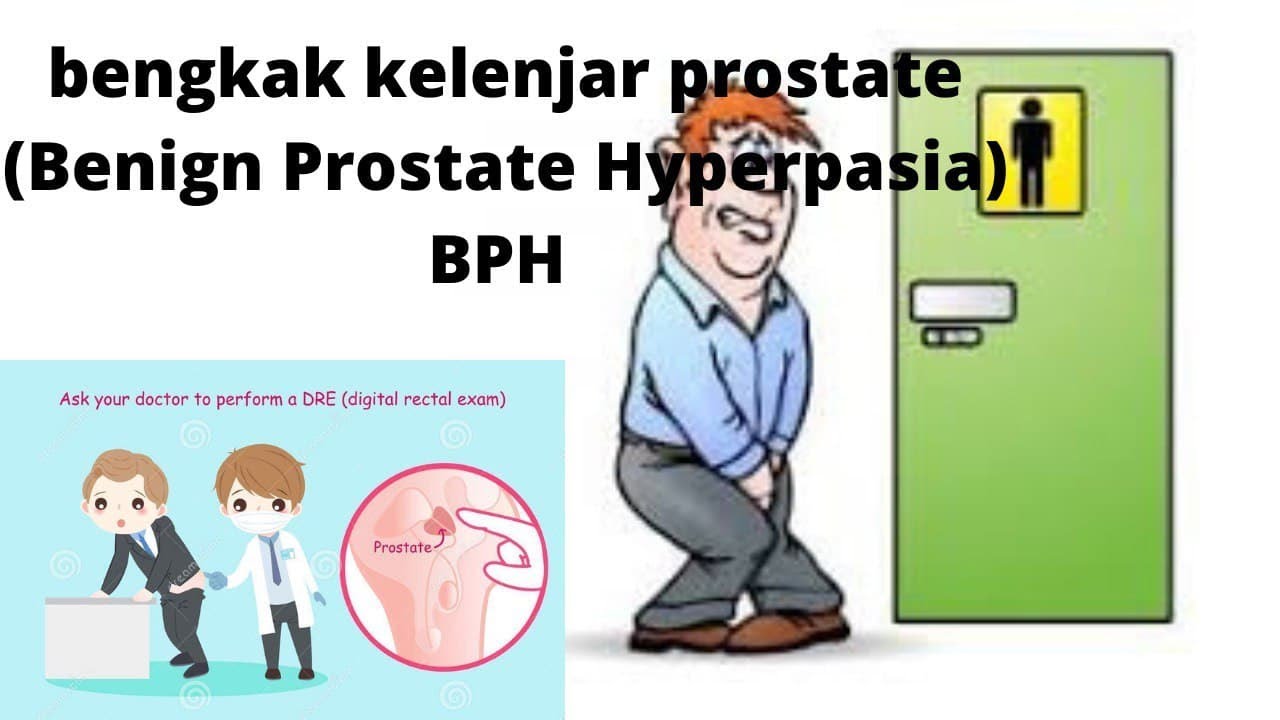 Kelenjar Prostate Bengkak (BPH) Benign Prostate Hyperplasia - YouTube