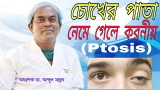 চোখের পাতা নিচে নেমে গেলে করনীয় (Ptosis) | Prof.Dr.Md Abdul Mannan