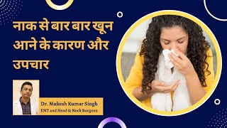 नाक से खून क्यों आता है । Why Blood Comes From Nose | Epistaxis