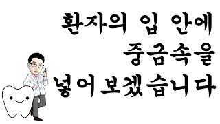 [백튜브] 아말감에서 수은이 나온다고 하는데 해도 괜찮을까?