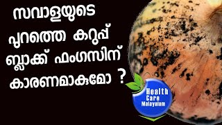 Black Fungus |സവാളയുടെ പുറത്തെ കറുത്ത പാളി ബ്ലാക്ക്​ ഫംഗസിന്​ കാരണമാകുമോ?