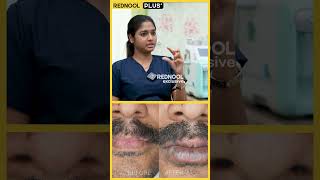 தம் அடிக்கிறவங்க இத பண்ணாதீங்க? - Dermatologist Dr Archana Explains | Acne