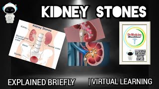 Kidney stone|Nephrolithiasis|Explained briefly|Virtual learning|Dr.Medicine