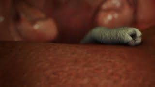 Tos de gusanos | Parásitos Asesinos | Discovery Channel Latinoamerica