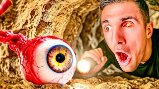 I Finally Saw my REAL EYEBALL Again..