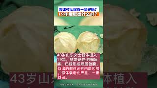 假體隆胸後，可以保持多久？ 取出是什麼樣？如需要瞭解更多可以添加V信: jm999778