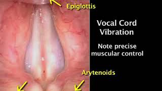 1-13. Vocal Cord Vibration