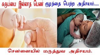 கருப்பை இல்லாத பெண் குழந்தை பெற்ற அதிசயம்