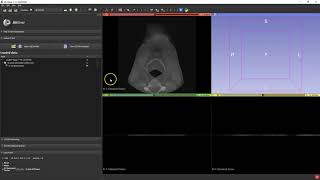 B4D Guide Module- 3D Slicer