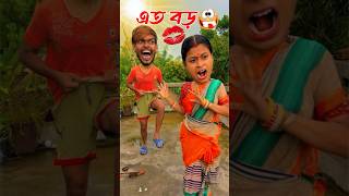 এত বড় 😂🤣 Bengali Comedy Video | Comedy Video | Funny Video #shorts #funny #comedy