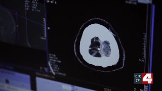 Report: cancer morality rates down, new diagnoses in woman and younger adults up