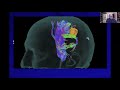 interactive case review motor cortex lesion