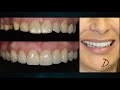 Dr. Federico Baena | Dentista Especialista en Youtube | Canal de Odontología y Salud