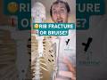 🧐Broken Rib Or Bruised Rib: How To Tell The Difference?