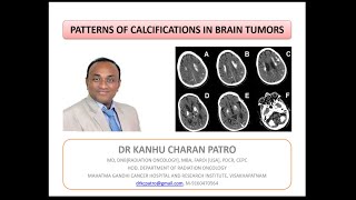 CRANIAL CALCIFICATIONS