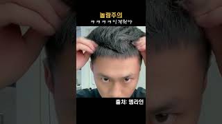 M자탈모인들 주목