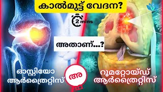 മുട്ടുവേദനയും സന്ധിവേദനയും | സന്ധിവാതം, ചികിത്സ, ചികിത്സ എന്നിവ മനസ്സിലാക്കുക