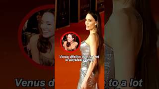 Angelina Jolie’s severe veins on her arms#youtubeshorts #shorts #celebrity #angelina