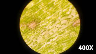 Elodea sp. in Hypertonic solution