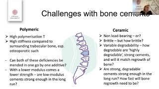 JMBBM Frontiers Webinar:  Cecilia Persson,  Uppsala University, Sweden, Jan. 29, 2021