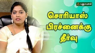 சொரியாஸ் பிரச்னைக்கு தீர்வு? | Doctor On Call | 23/06/2018 | PuthuyugamTV