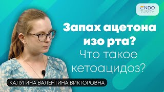 Почему нельзя игнорировать запах ацетона изо рта? Что такое кетоацидоз?