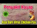 KAYAP BERASAL DARI VIRUS CHICKEN POX - @DrManTtdi