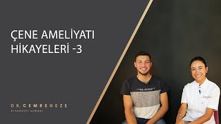 Çene Ameliyatı Hikayeleri - 3