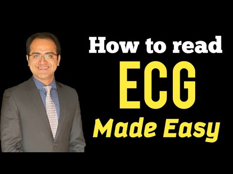 ECG Interpretation Made Easy; How To Read 12 Lead EKG (Basics), USMLE ...