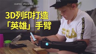 我就像鋼鐵人！3D列印打造「英雄」手臂 - 機械手臂 - 新唐人亞太電視台