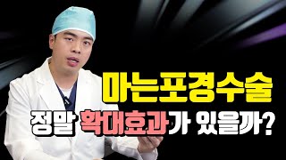 마는포경수술을 하면 정말 확대효과도 볼 수 있나요?