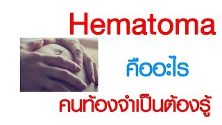 พบหมอเสรี ตอนที่ 212 : Hematoma คืออะไร