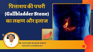 पित्ताशय की पथरी Gallbladder Stone का लक्षण और इलाज | Symptoms And Treatment of Gallbladder Stone