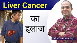 Liver Cancer Treatment | Liver Cancer Symptoms | Best Homeopathic Treatment of Cancer