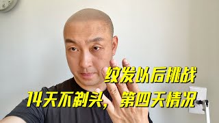 纹发以后我来挑战14天不剃头，看看结果什么样！分享第四天的情况……纹发师江涛Scalp Micropigmentation.中国鼎点视觉3D纹发