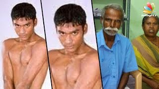 Birthmarks removed from Dhanush's body, suggest medical reports | Paternity Case
