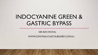 Gastric bypass with Indocyanine Green (Part 1) - Dr Ken Wong, Newcastle NSW