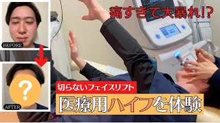 【切らないフェイスリフト】医療用ハイフをスタッフが体験してみた結果