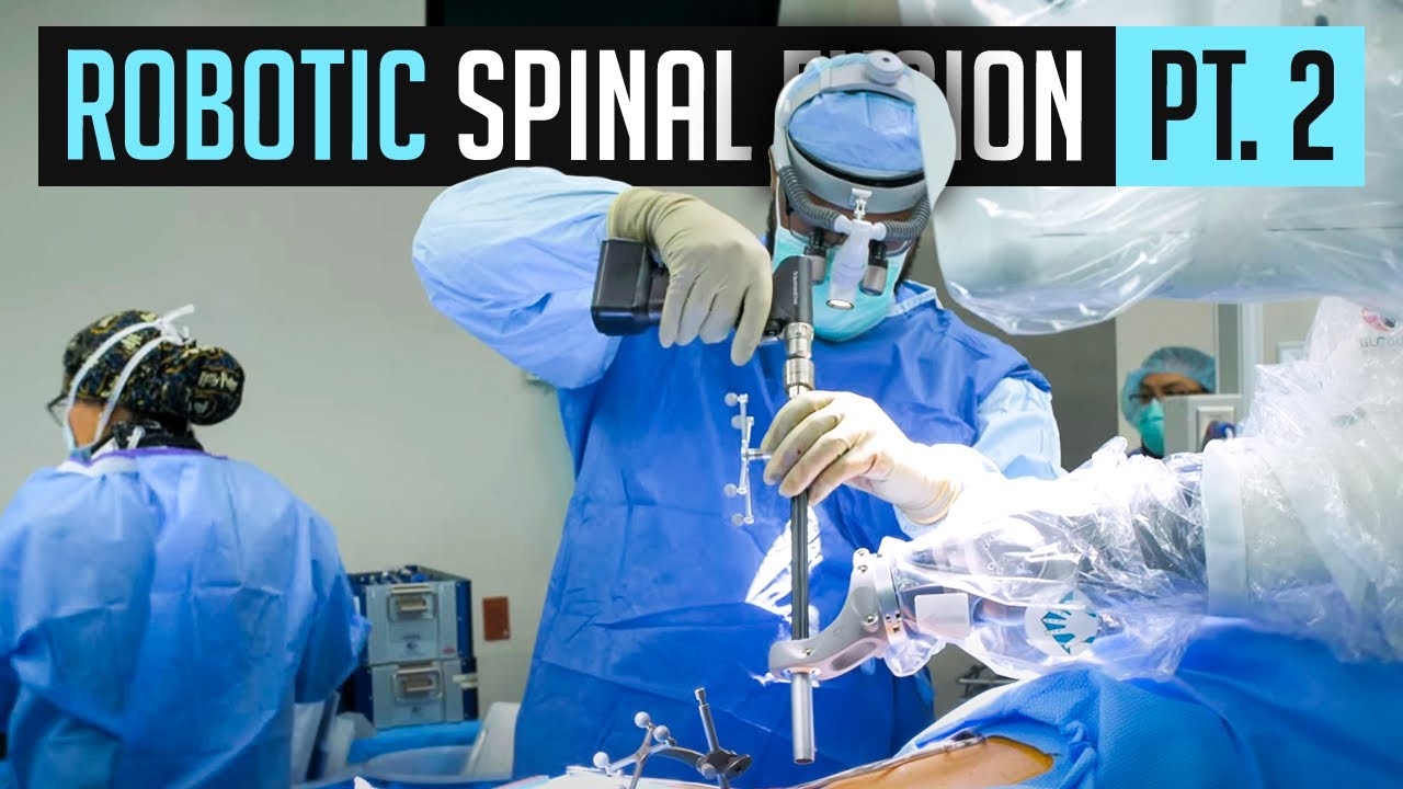 Robotic Spinal Fusion Part 2 Youtube