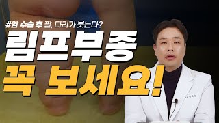 암수술후 림프부종 원인과 치료방법