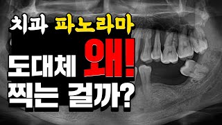 치과 가면 파노라마 사진 찍는 이유? 치대남이 알려줄게!